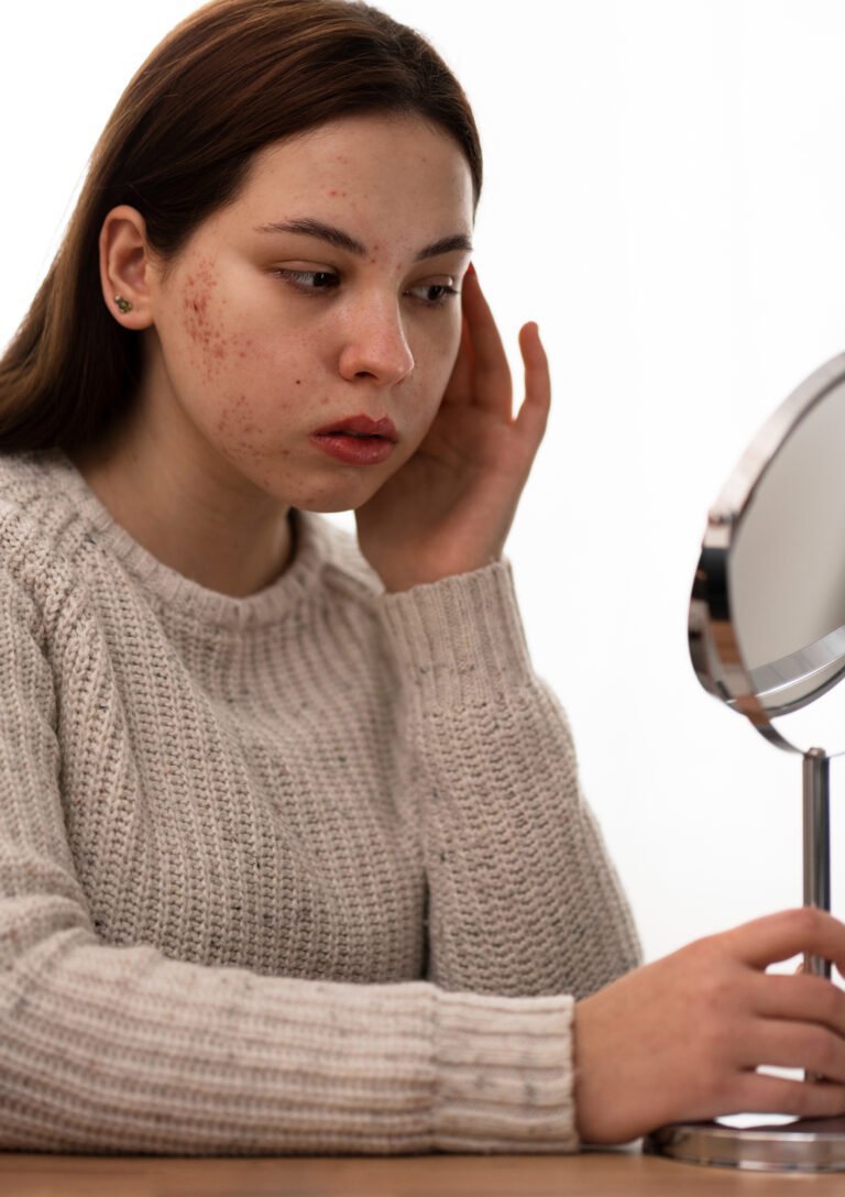 person dealing with rosacea
